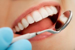 How Long Do Cerec Crowns Last?